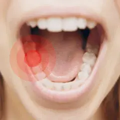 Ile trwa ból zęba? Przyczyny, czas trwania i kiedy do dentysty