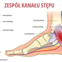Anatomia kanału stępu: nerw piszczelowy, kości stopy i ścięgna. Zespół kanału stępu to schorzenie, które może powodować ból i drętwienie.