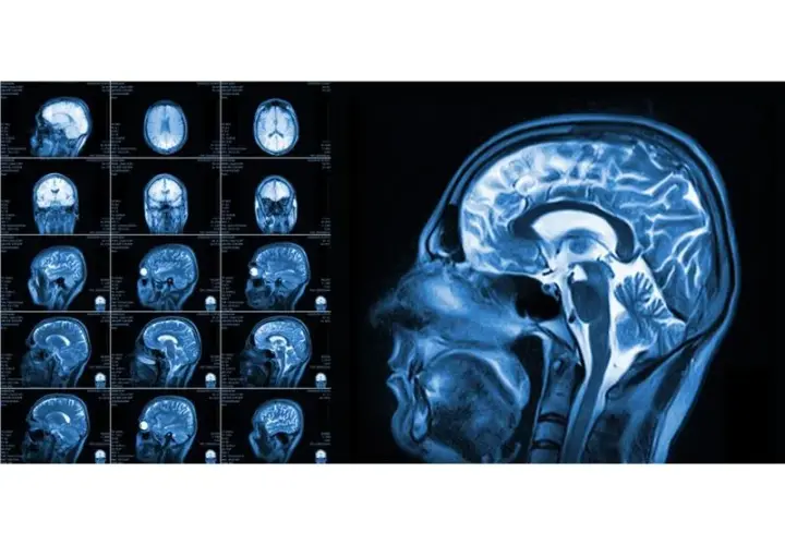 Fizjoterapeuta a rezonans magnetyczny (MRI): kto wystawia skierowanie?