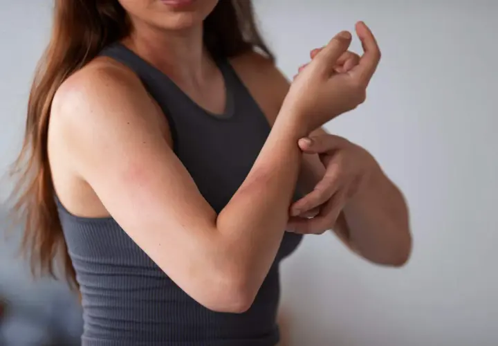 Alergia na roztocza: Leki, odczulanie jak wreszcie odetchnąć?