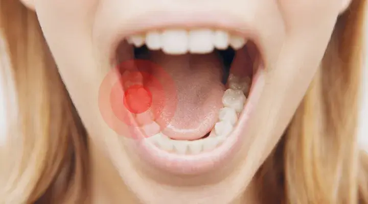 Ile trwa ból zęba? Przyczyny, czas trwania i kiedy do dentysty