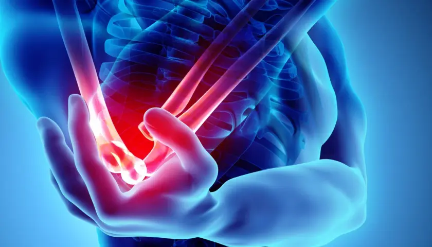 Anatomical rendering of a human arm showing a glowing red area indicating **ból łokcia**.