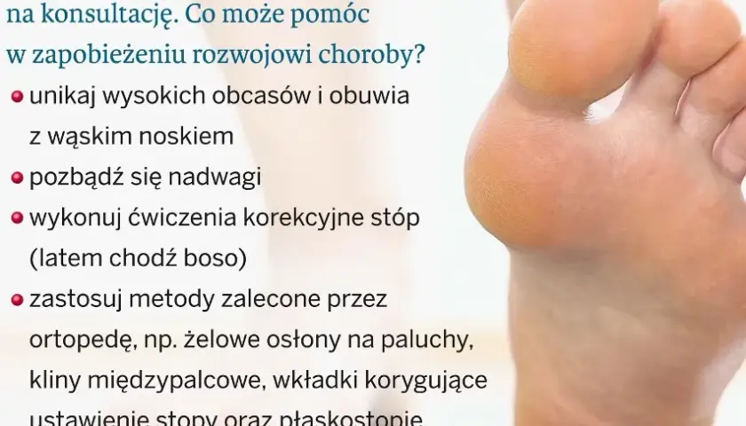 Jak wyleczyć haluksy? Pełny przewodnik: metody, koszty, rekonwalescencja