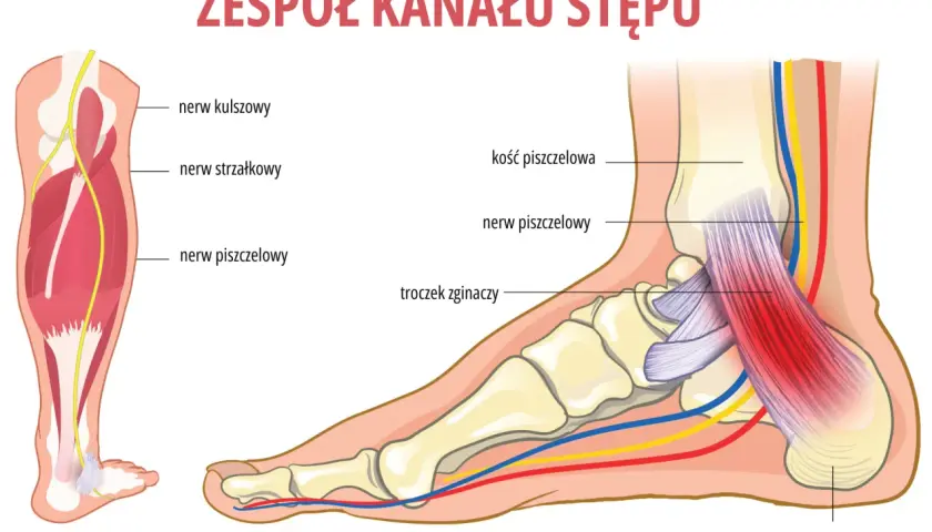 Anatomia kanału stępu: nerw piszczelowy, kości stopy i ścięgna. Zespół kanału stępu to schorzenie, które może powodować ból i drętwienie.