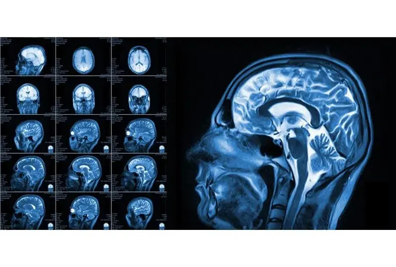 Fizjoterapeuta a rezonans magnetyczny (MRI): kto wystawia skierowanie?