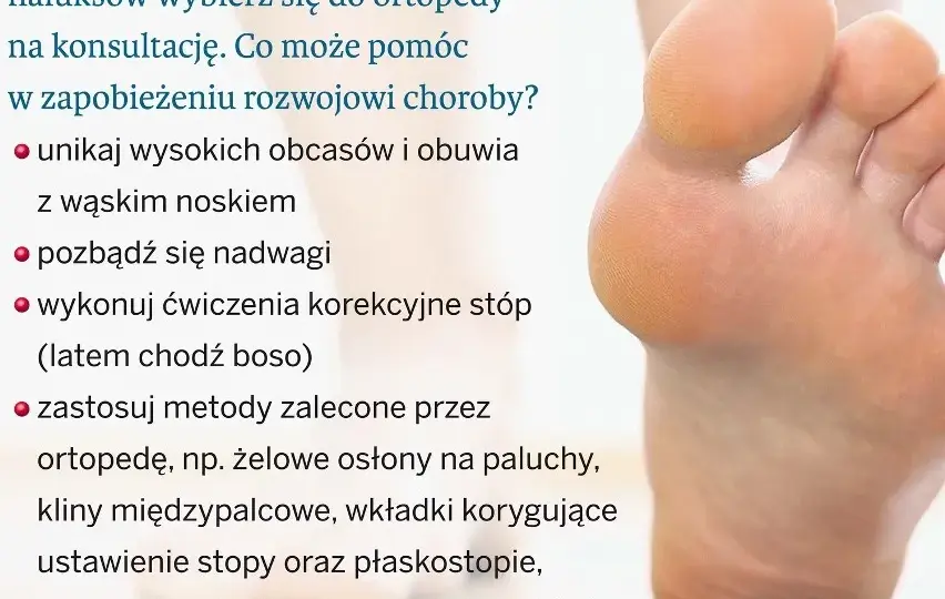 Jak wyleczyć haluksy? Pełny przewodnik: metody, koszty, rekonwalescencja