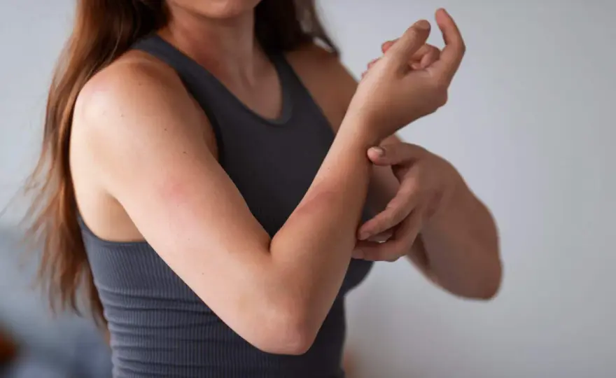 Alergia na roztocza: Leki, odczulanie jak wreszcie odetchnąć?