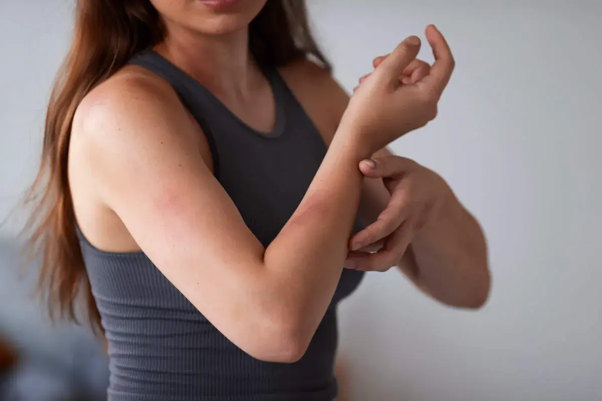 Alergia na roztocza: Leki, odczulanie jak wreszcie odetchnąć?