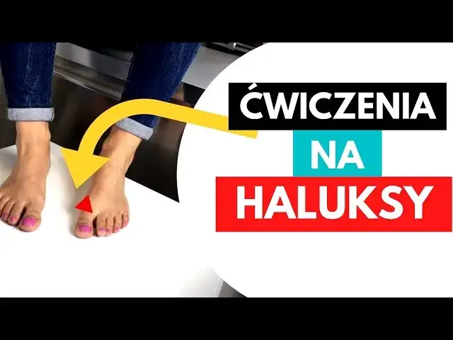 ćwiczenia na haluksy, korekcja palucha koślawego