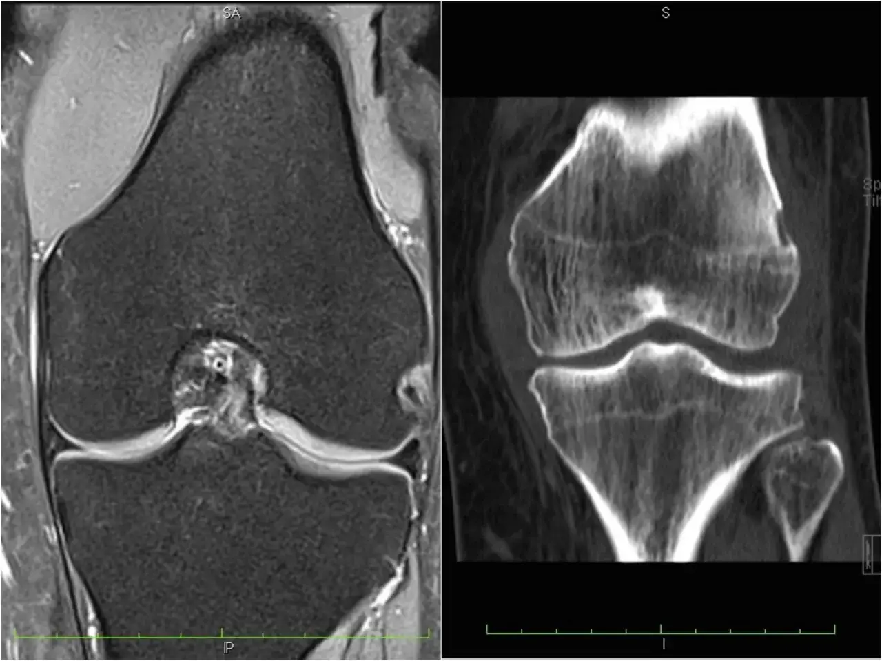 Ortopeda diagnoza badania obrazowe