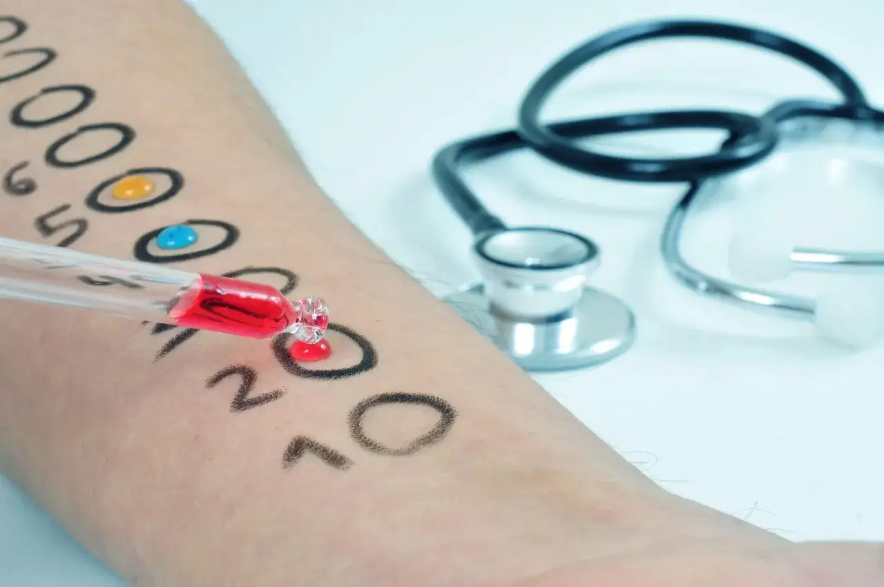 rodzaje test&oacute;w alergicznych sk&oacute;rnych